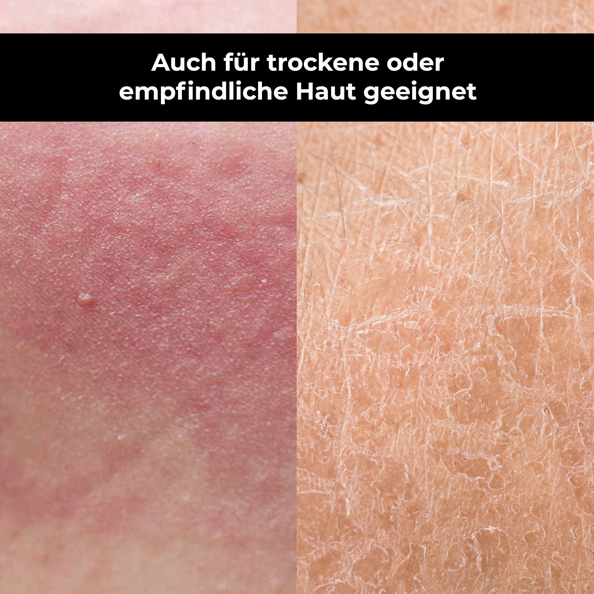 Person, Haut, Gesicht, Kopf, Hals