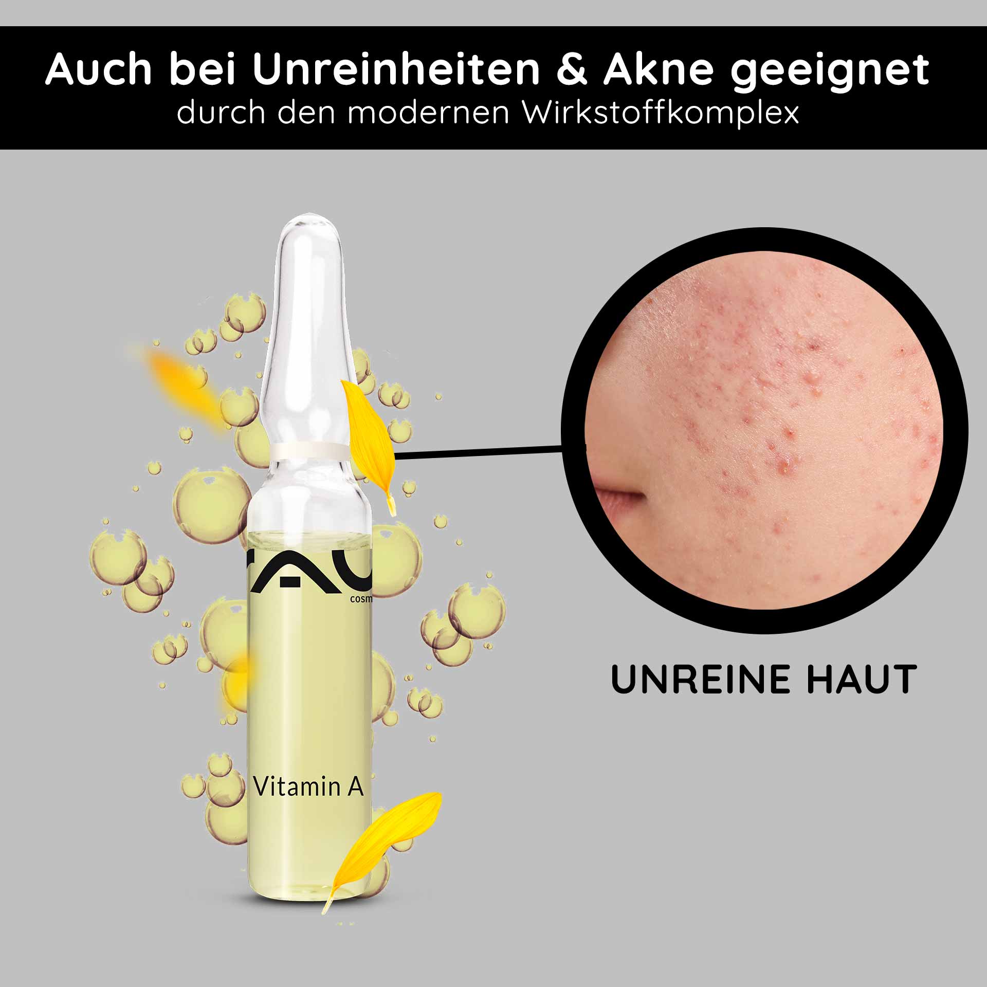 Vitamin A Ampullen 14x2 ml Retinol Serum bei trockener Haut Vitamin A Ampulle von RAU Cosmetics, hervorgehoben für Akne und Unreinheiten, mit einer Nahaufnahme unreiner Haut, umgeben von Blasen und Blütenblättern, die den modernen Wirkstoffkomplex hervorheben.
