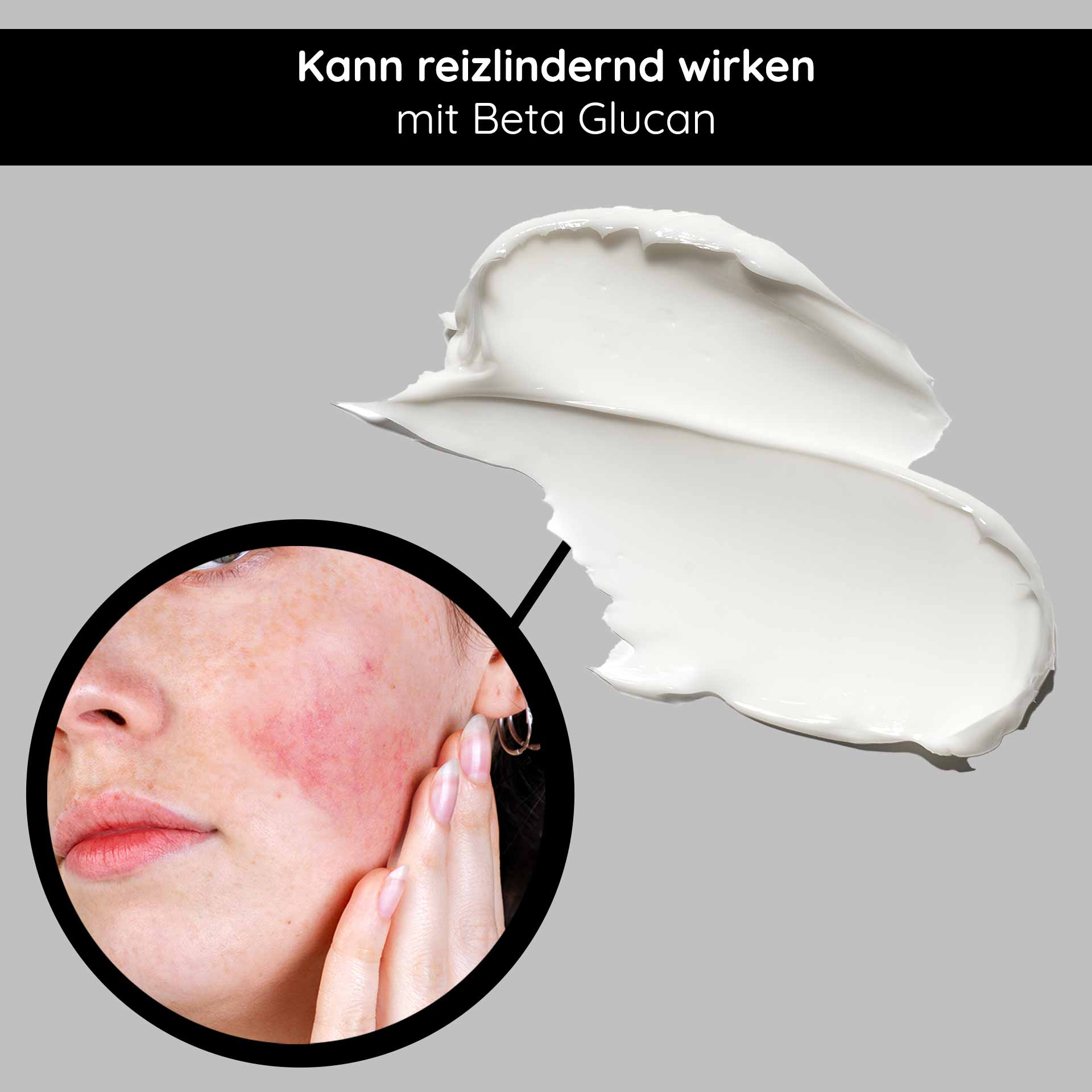 Beta Glucan Recovery Mask 200 ml Maske für irritierte Haut Gesichtsmaske mit Beta Glucan, Anwendung zur Linderung von Hautirritationen, Nahaufnahme einer Person mit gereizter Haut und Creme.