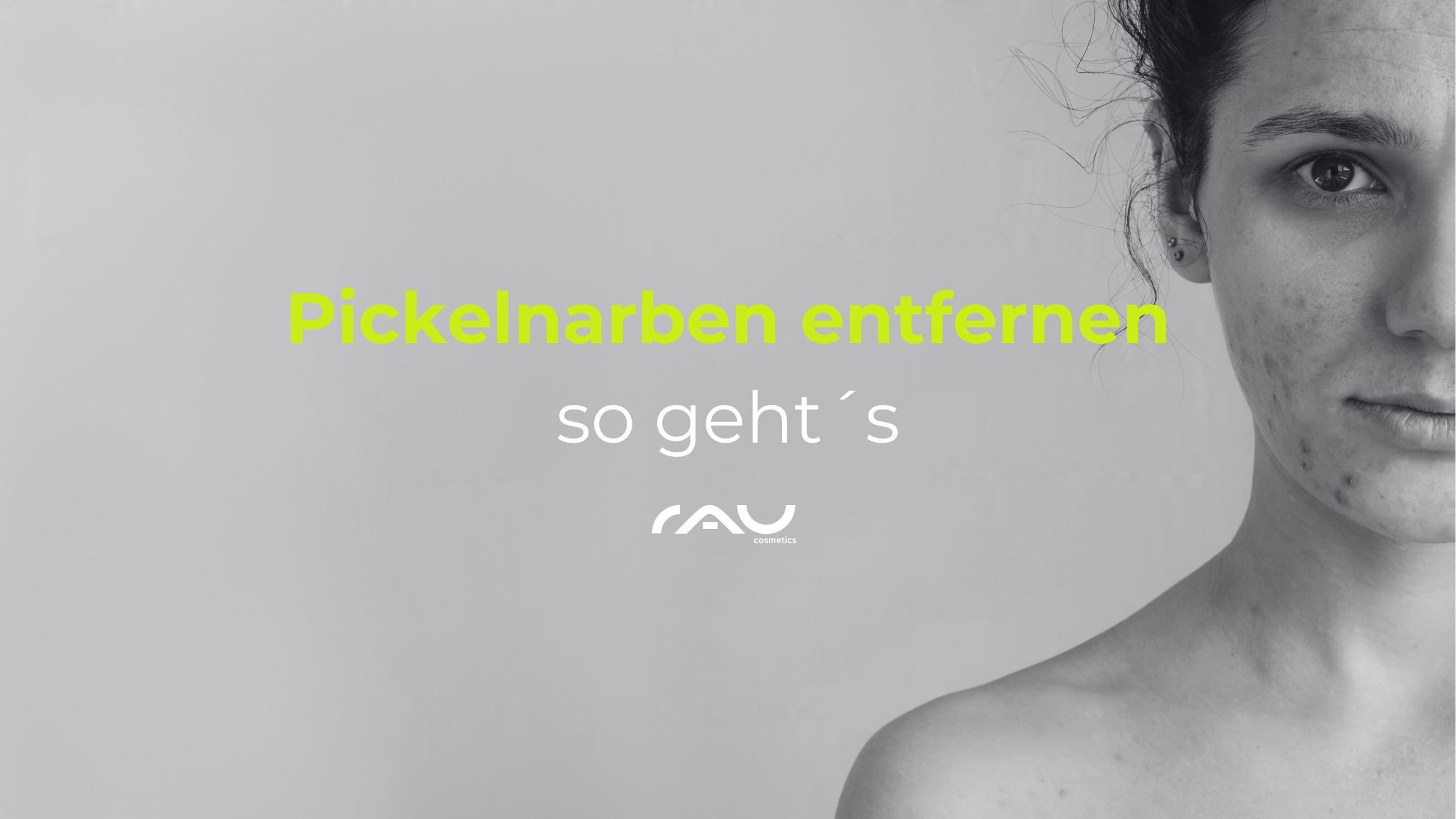 Frau mit Akne-Narben und Text "Pickelnarben entfernen so geht's", RAU Cosmetics Logo, Hautpflege.