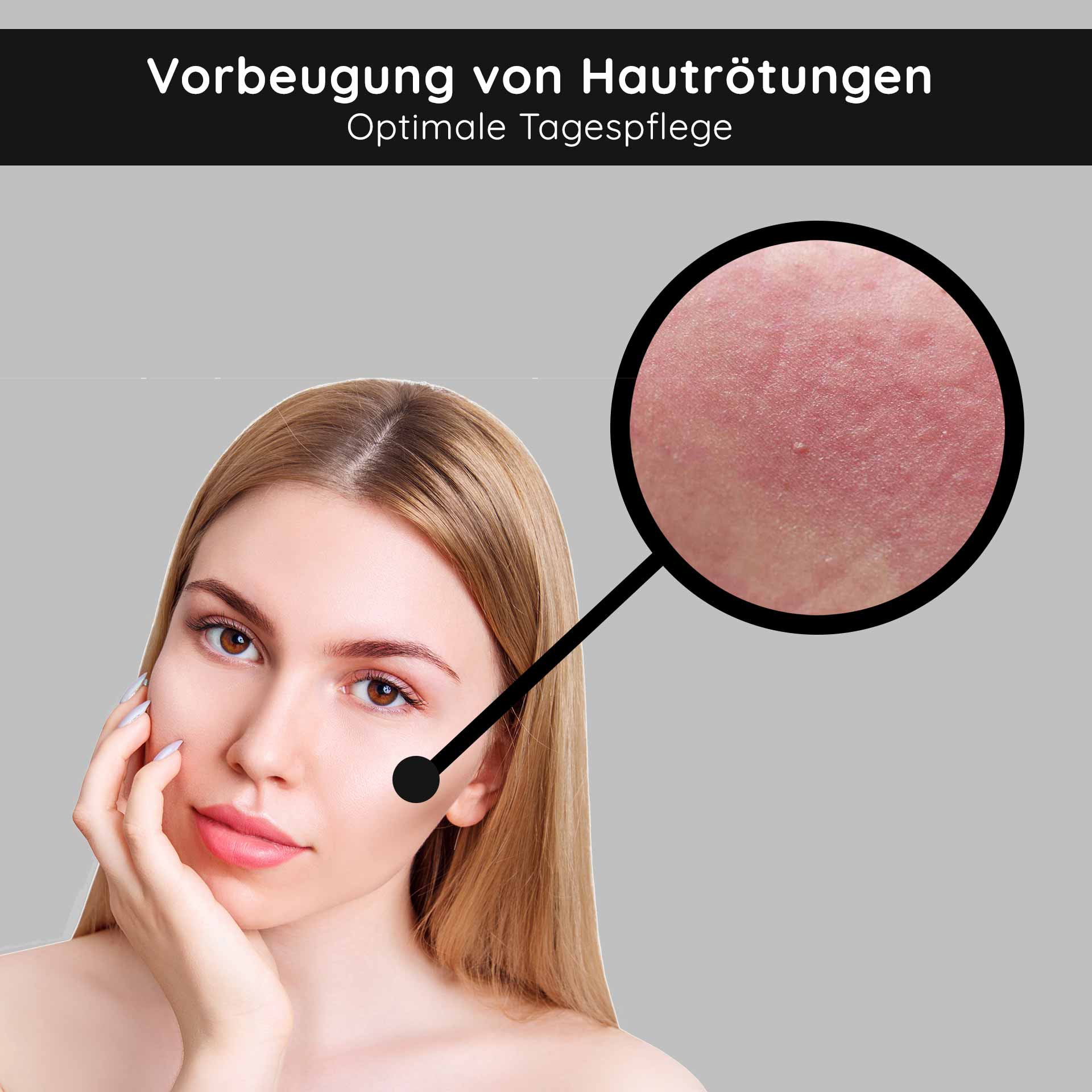 Vitamin A Ampullen 14x2 ml Retinol Serum bei trockener Haut Frau mit glatter Haut und langen, blonden Haaren, zeigt Hautrötungen im vergrößerten Bereich, betont optimale Tagespflege zur Vorbeugung von Hautproblemen.
