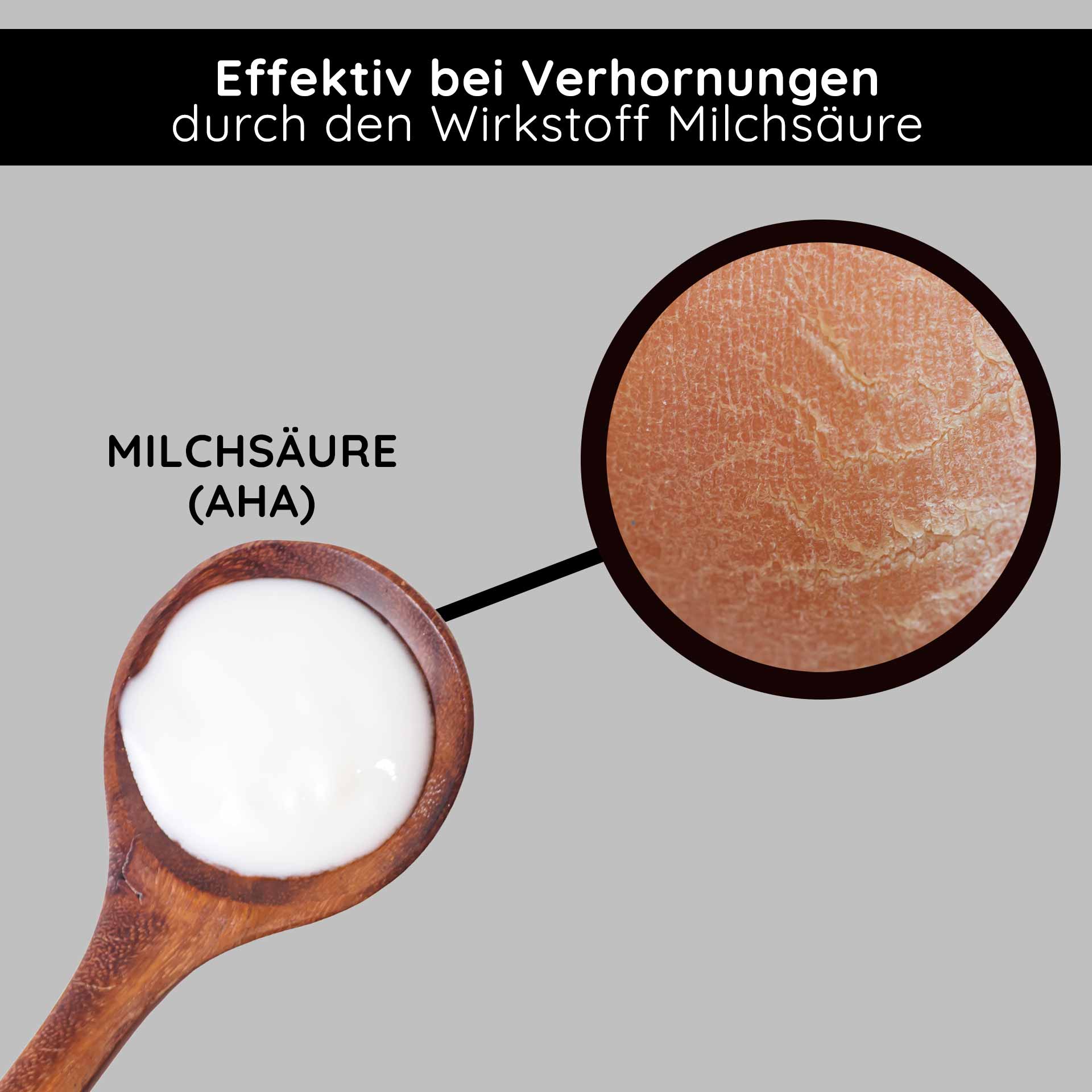 Fruit Acid & BHA Cream 50 ml - BHA Fruchtsäurecreme Milchsäure (AHA) in einem Holzlöffel, wirksam gegen Verhornungen, mit Hauttextur im Detail.