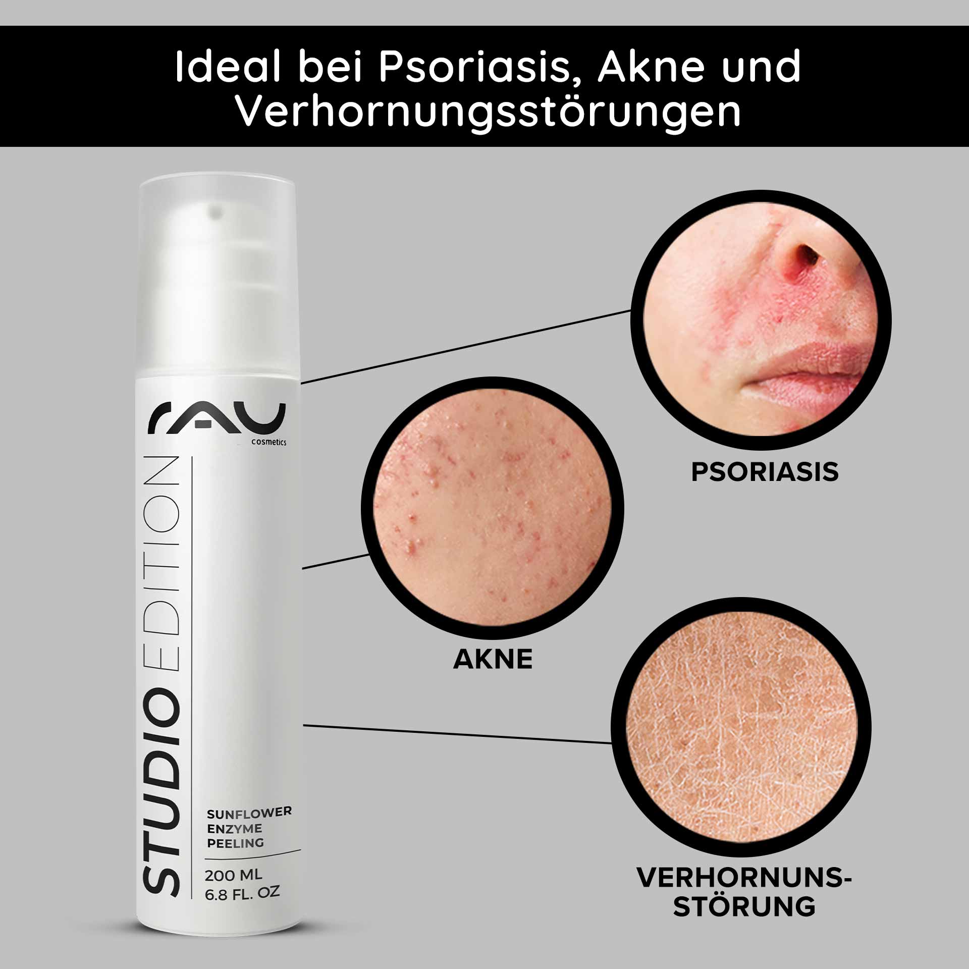 Sunflower Enzyme Peeling 200 ml Chemisches Enzymepeeling Verpackung des RAU Sunflower Enzyme Peeling mit hervorgehobenen Vorteilen bei Schuppenflechte, Akne und Keratose; Nahaufnahmen von Hautzuständen veranschaulichen die Wirksamkeit.