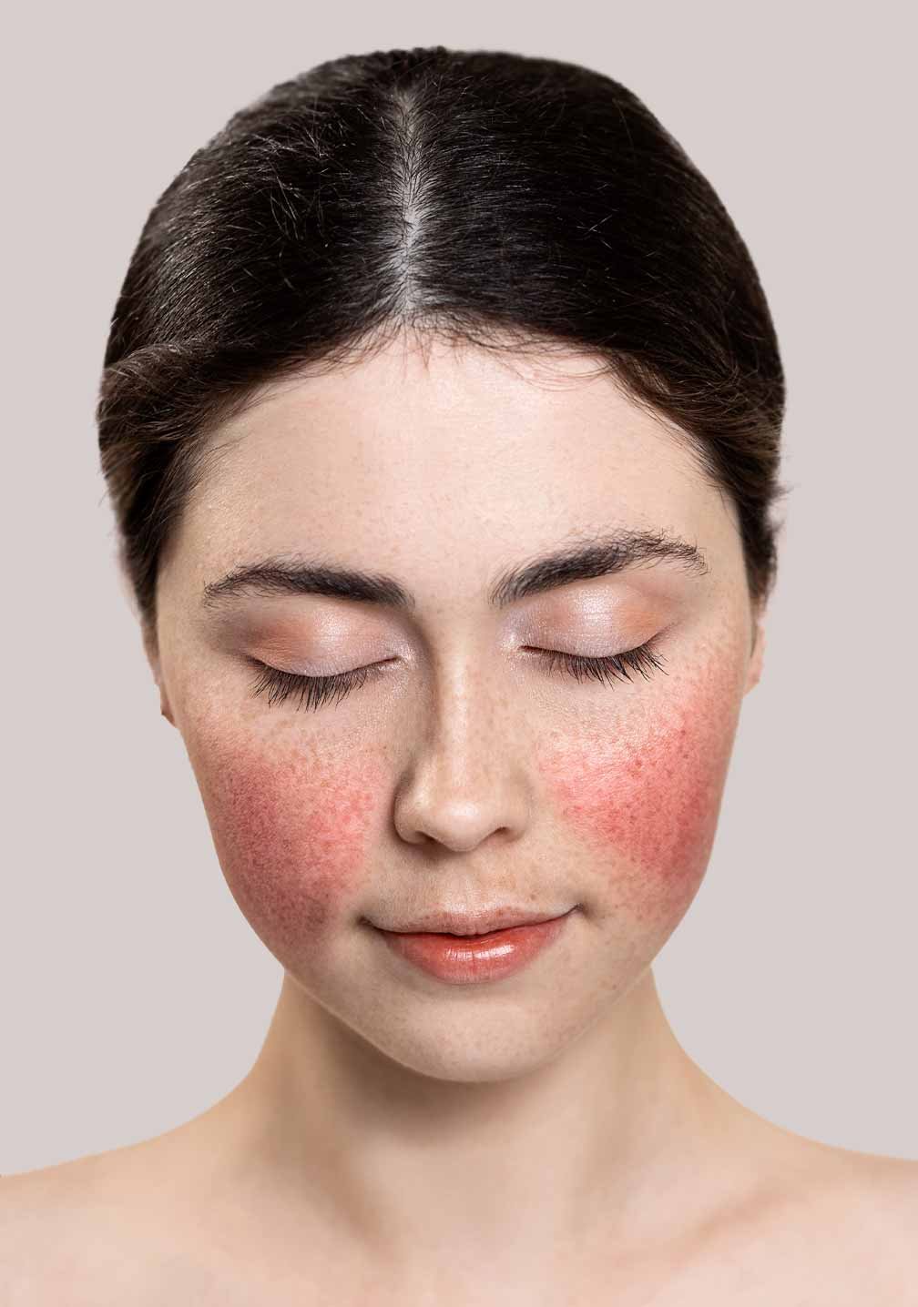 Junge Frau mit geschlossenen Augen und rosigen Wangen, vor neutralem Hintergrund, der die natürliche Schönheit betont.