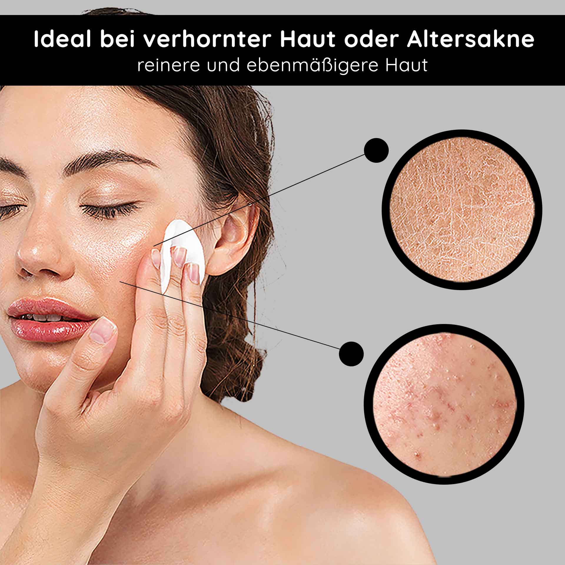 AHA Gesichtswasser: Anti-Aging mit Fruchtsäure & weißem Tee Frau mit Wattepad, das AHA Tonic auf Gesicht aufträgt, ideal bei verhornter Haut oder Altersakne, zeigt Hautunreinheiten und Texturverbesserung.