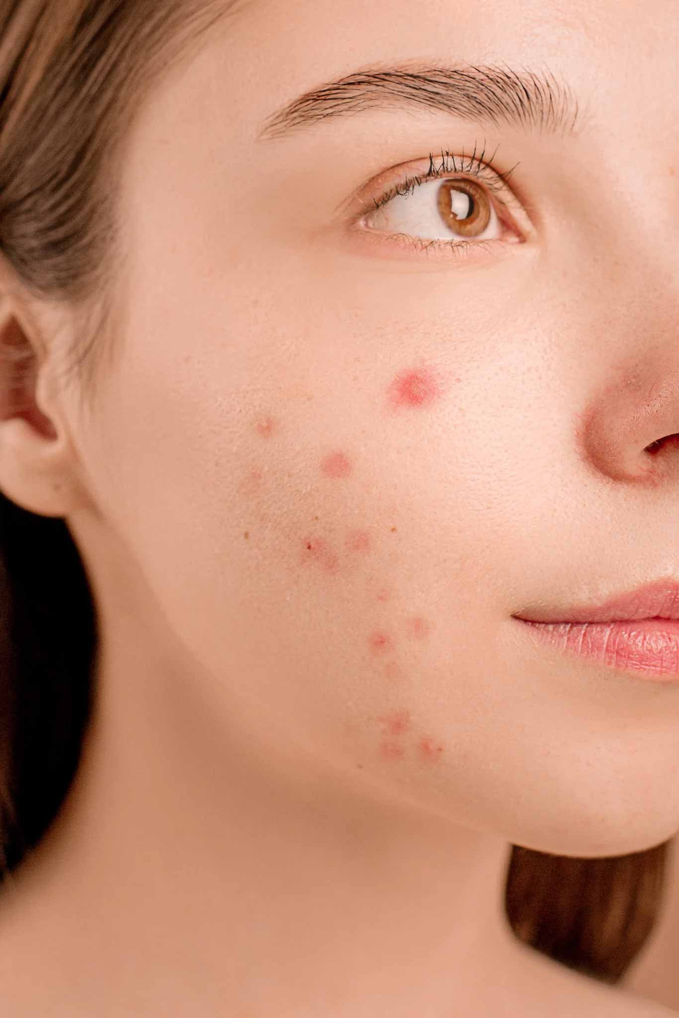 pexels-anna-nekrashevich-6475987-2