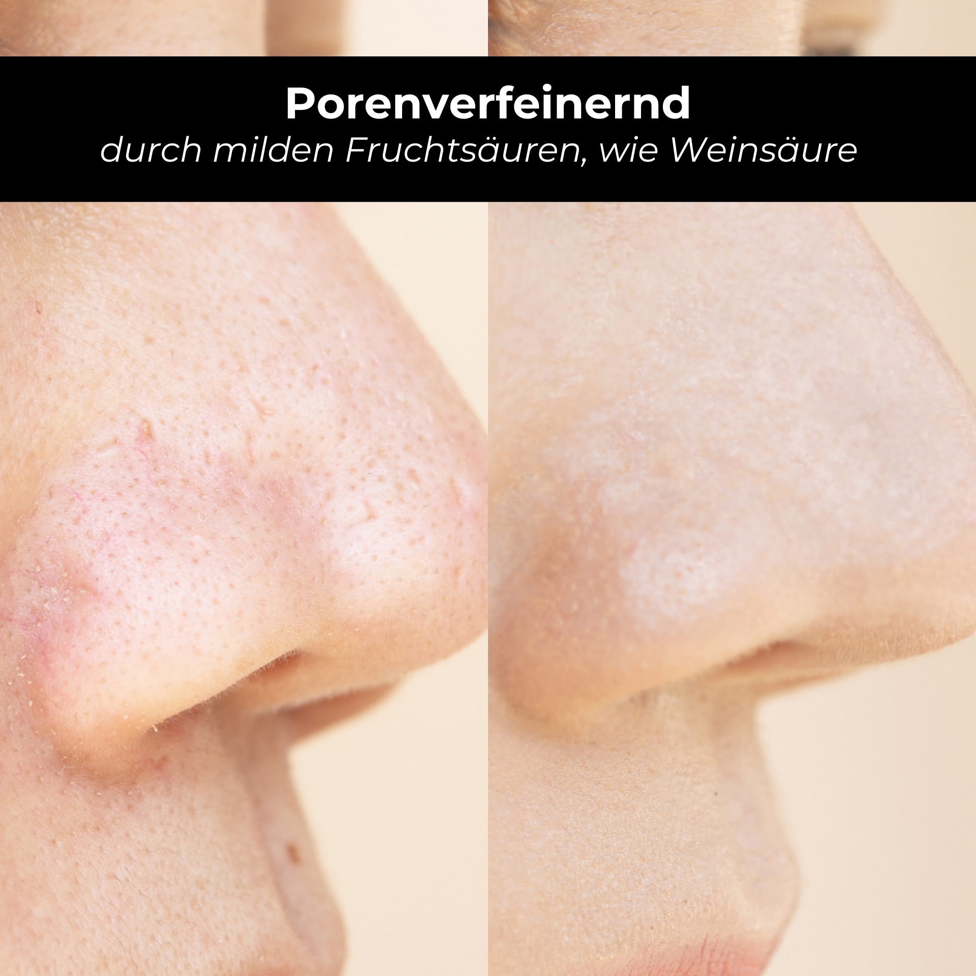 AHA Tonic 50 ml - Erfrischendes Tonic mit milden Fruchtsäuren Porenverfeinerndes Hautbild durch milde Fruchtsäuren, wie Weinsäure, vor und nach Anwendung des RAU AHA Tonic.